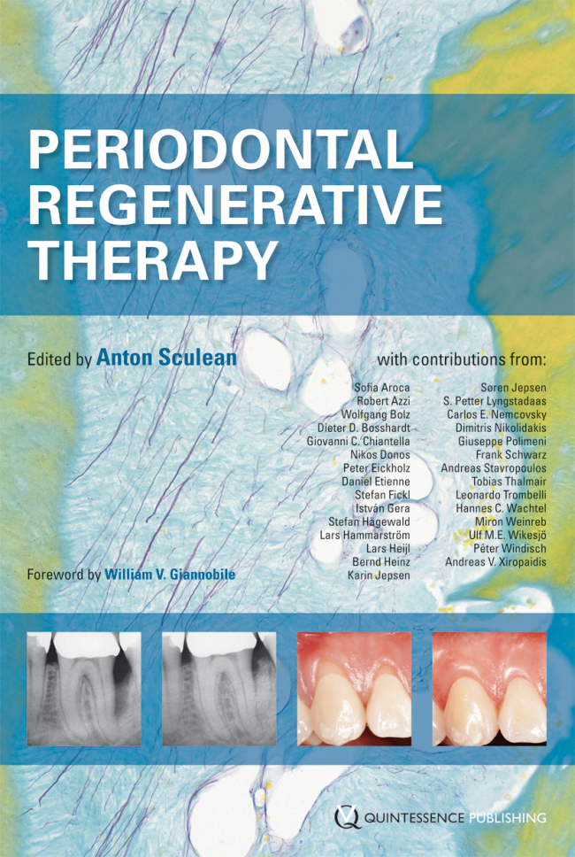 Sculean: Periodontal Regenerative Therapy