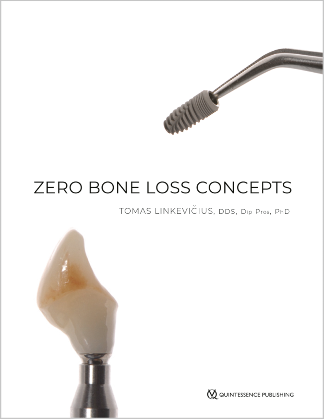 Linkevičius: Zero Bone Loss Concepts