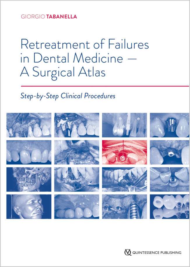 Tabanella: Retreatment of Failures in Dental Medicine - A Surgical Atlas