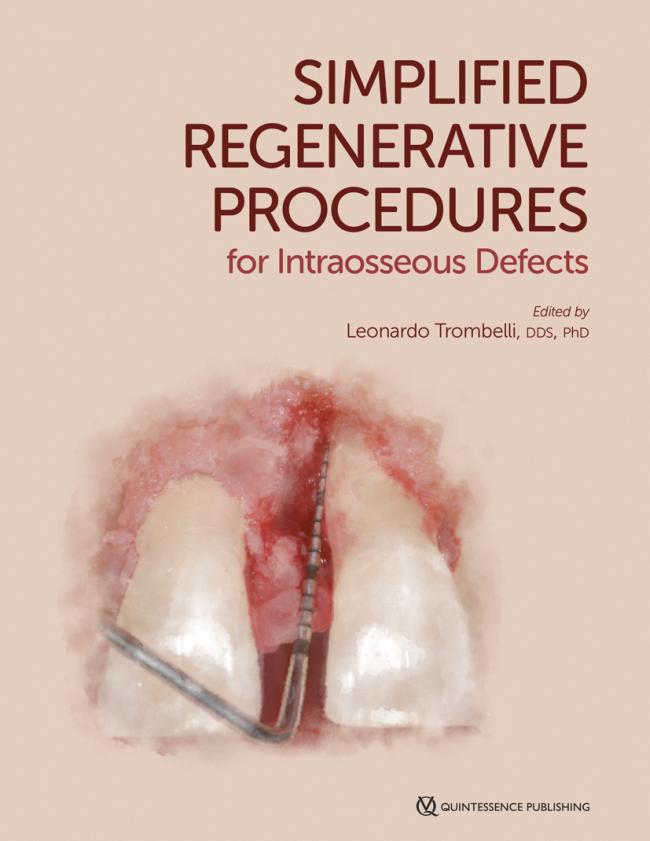 Trombelli: Simplified Regenerative Procedures for Intraosseous Defects