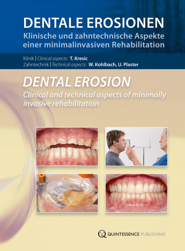 Kresic: Dentale Erosionen / Dental Erosion
