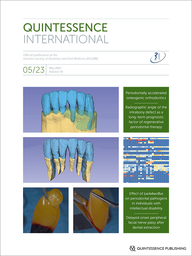 Quintessence International, 5/2023