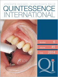 Quintessence International, 6/2014