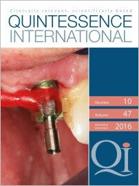 Quintessence International, 10/2016
