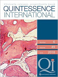 Quintessence International, 6/2018