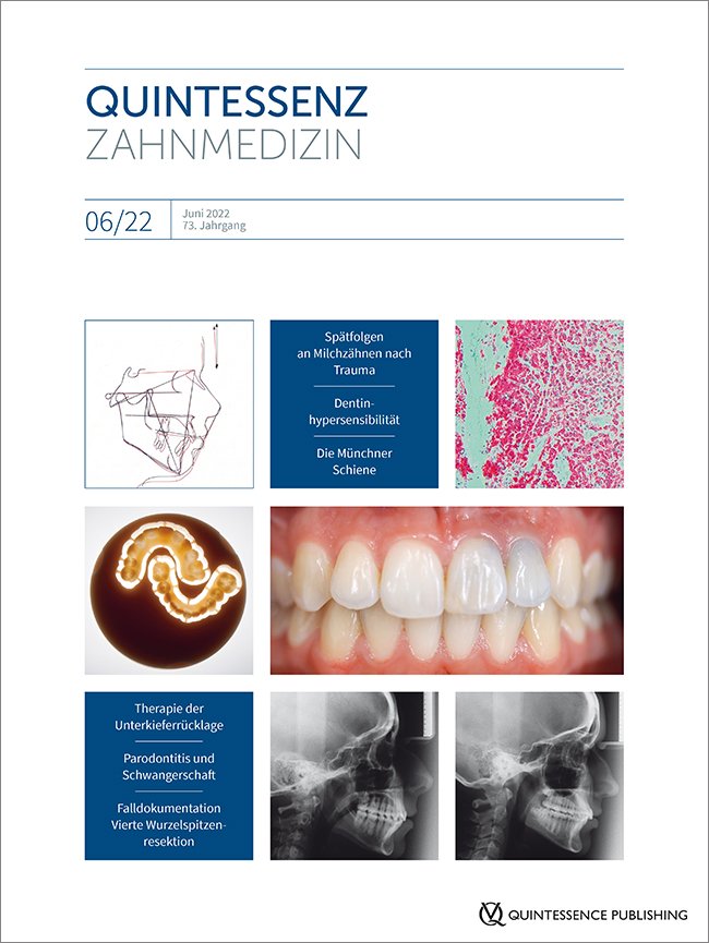 Quintessenz Zahnmedizin, 6/2022