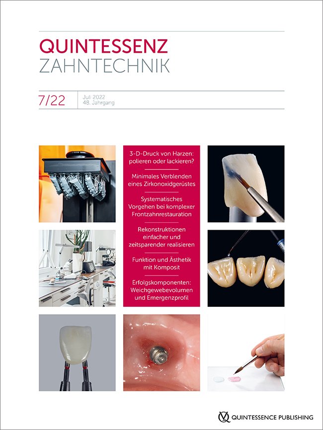 QZ - Quintessenz Zahntechnik, 7/2022