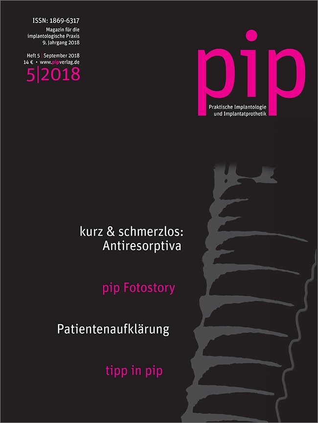 pip - Praktische Implantologie und Implantatprothetik, 5/2018