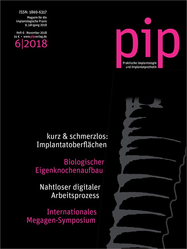 pip - Praktische Implantologie und Implantatprothetik, 6/2018