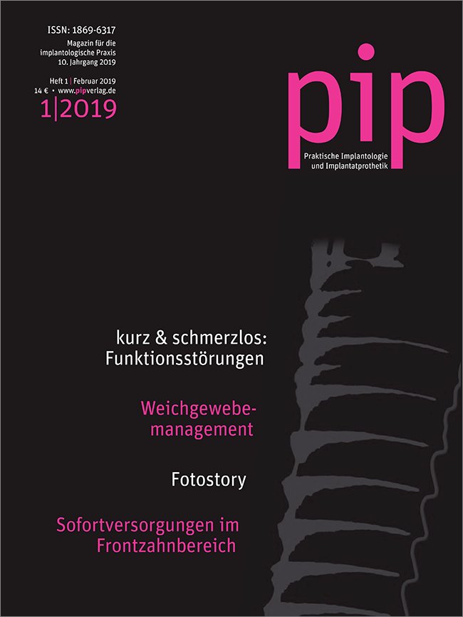 pip - Praktische Implantologie und Implantatprothetik, 1/2019