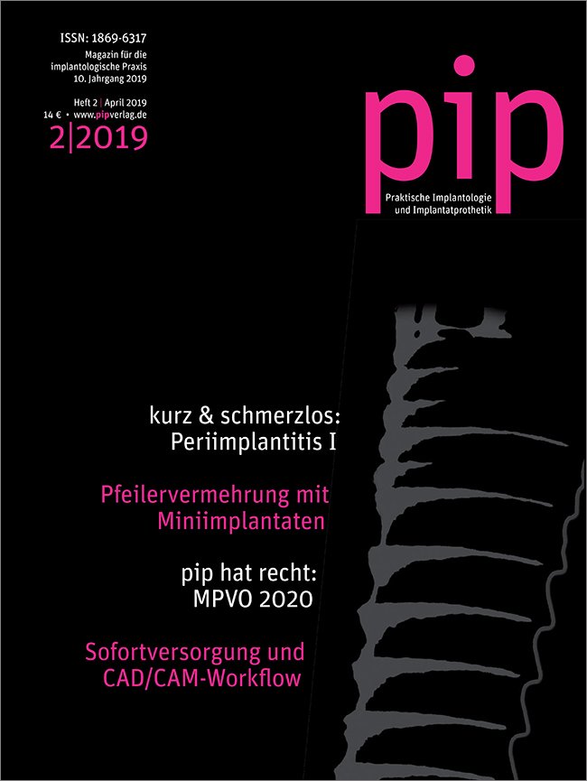 pip - Praktische Implantologie und Implantatprothetik, 2/2019