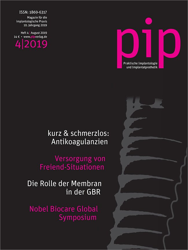 pip - Praktische Implantologie und Implantatprothetik, 4/2019