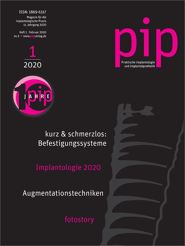 pip - Praktische Implantologie und Implantatprothetik, 1/2020