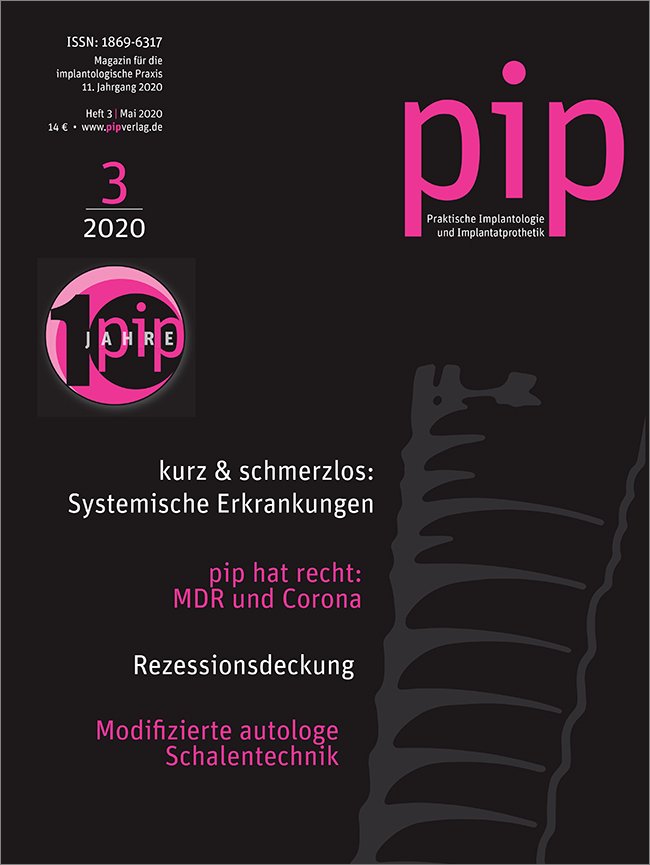 pip - Praktische Implantologie und Implantatprothetik, 3/2020