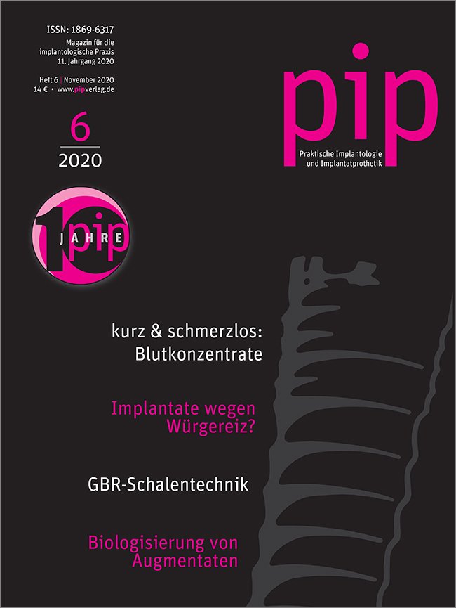 pip - Praktische Implantologie und Implantatprothetik, 6/2020