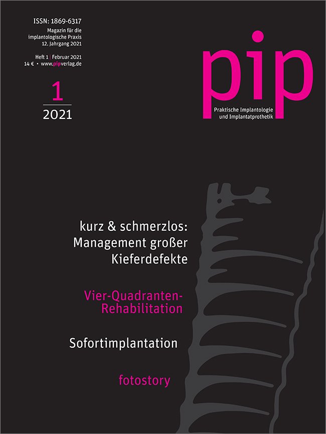 pip - Praktische Implantologie und Implantatprothetik, 1/2021