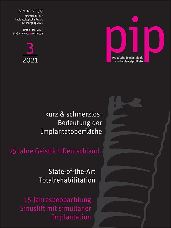 pip - Praktische Implantologie und Implantatprothetik, 3/2021