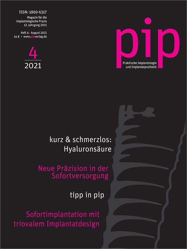 pip - Praktische Implantologie und Implantatprothetik, 4/2021