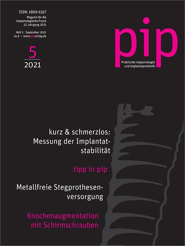 pip - Praktische Implantologie und Implantatprothetik, 5/2021