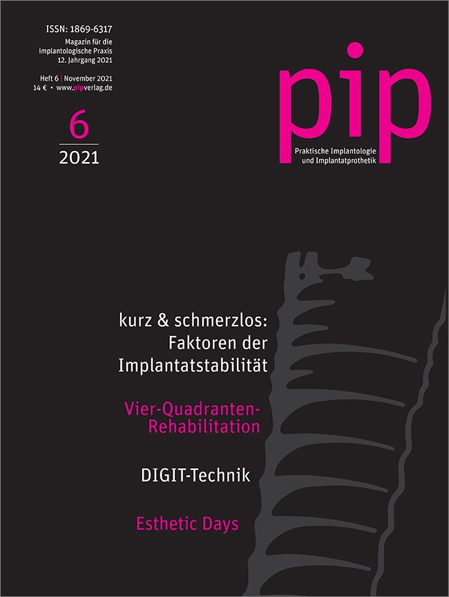 pip - Praktische Implantologie und Implantatprothetik, 6/2021