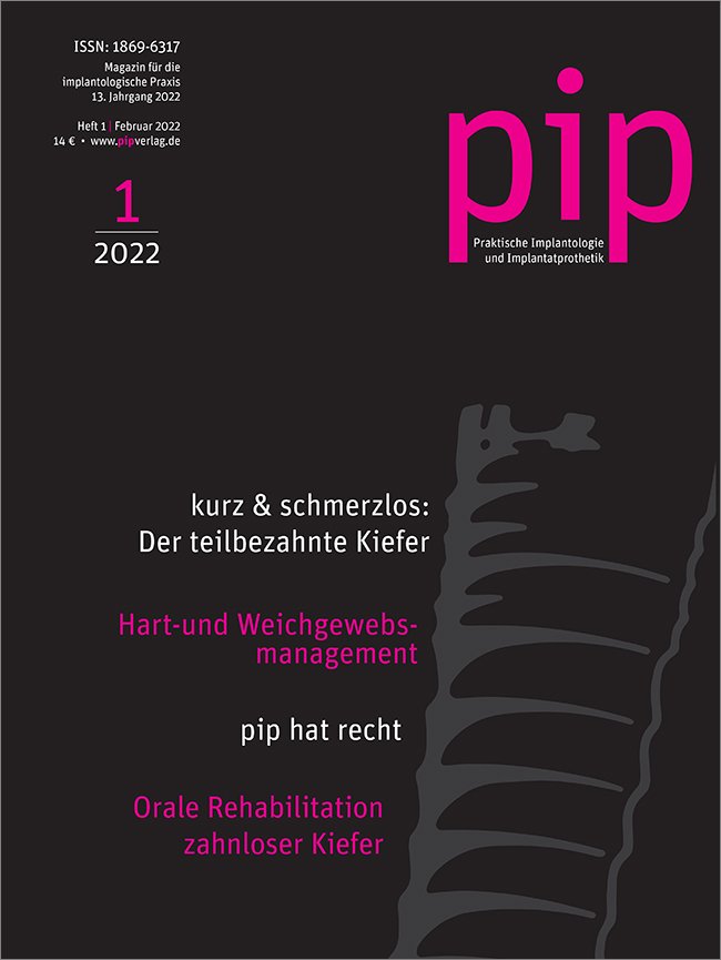 pip - Praktische Implantologie und Implantatprothetik, 1/2022