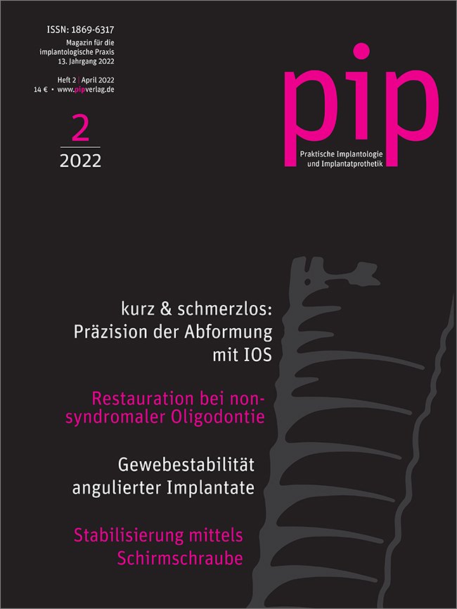 pip - Praktische Implantologie und Implantatprothetik, 2/2022