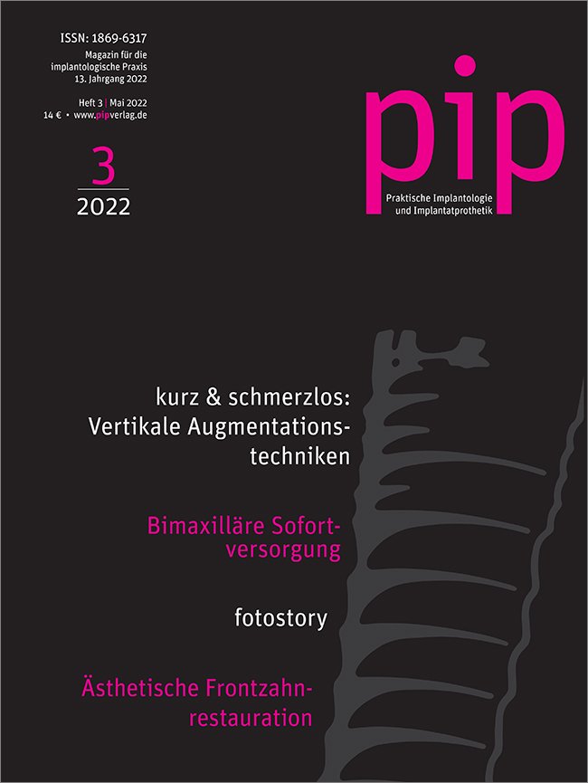 pip - Praktische Implantologie und Implantatprothetik, 3/2022
