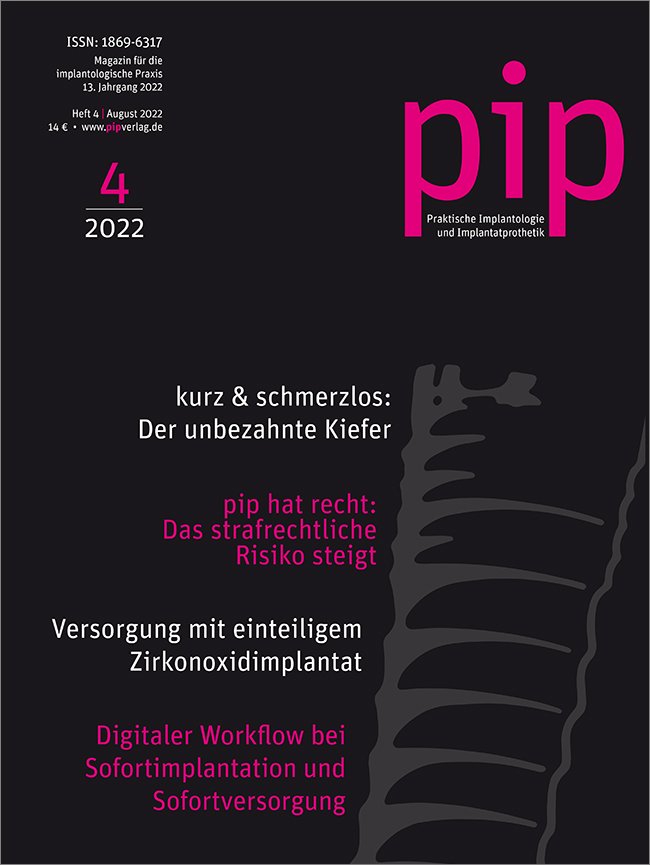 pip - Praktische Implantologie und Implantatprothetik, 4/2022