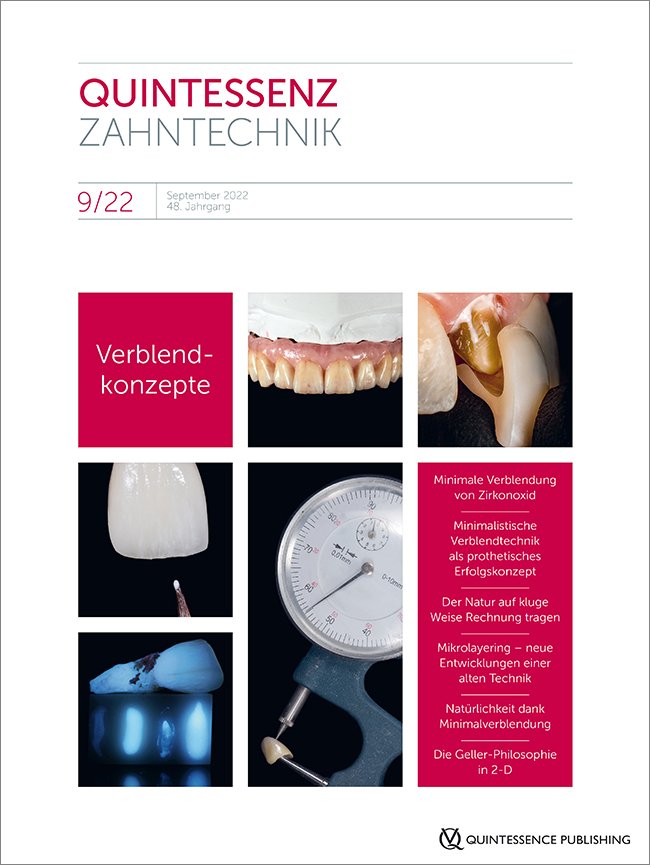 QZ - Quintessenz Zahntechnik, 9/2022