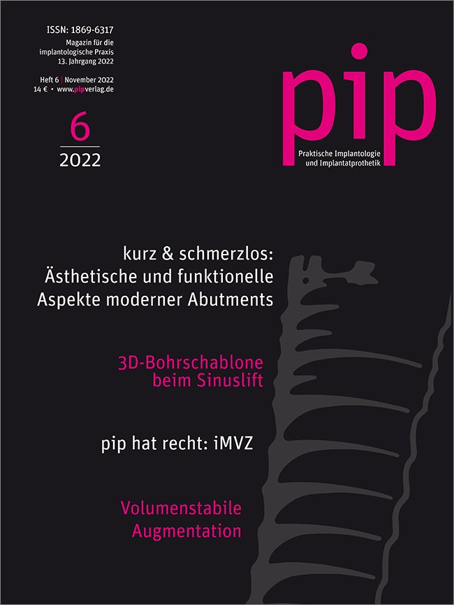 pip - Praktische Implantologie und Implantatprothetik, 6/2022