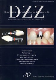 Deutsche Zahnärztliche Zeitschrift, 5/2008