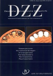 Deutsche Zahnärztliche Zeitschrift, 8/2008