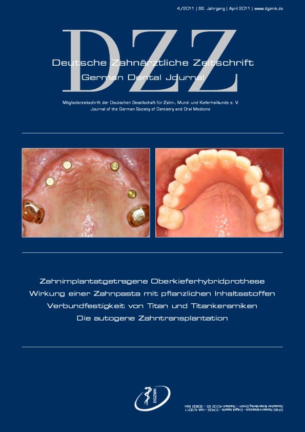 Deutsche Zahnärztliche Zeitschrift, 4/2011