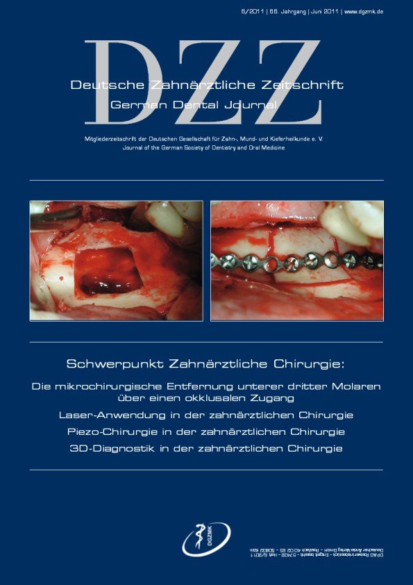 Deutsche Zahnärztliche Zeitschrift, 6/2011