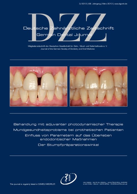 Deutsche Zahnärztliche Zeitschrift, 3/2013