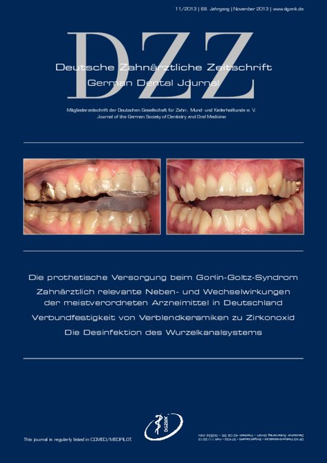 Deutsche Zahnärztliche Zeitschrift, 11/2013