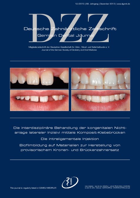 Deutsche Zahnärztliche Zeitschrift, 12/2013