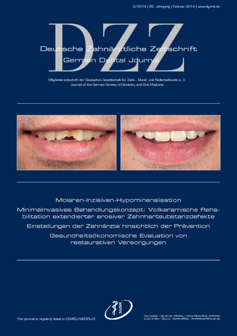 Deutsche Zahnärztliche Zeitschrift, 2/2014