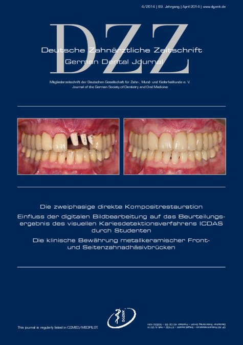 Deutsche Zahnärztliche Zeitschrift, 4/2014