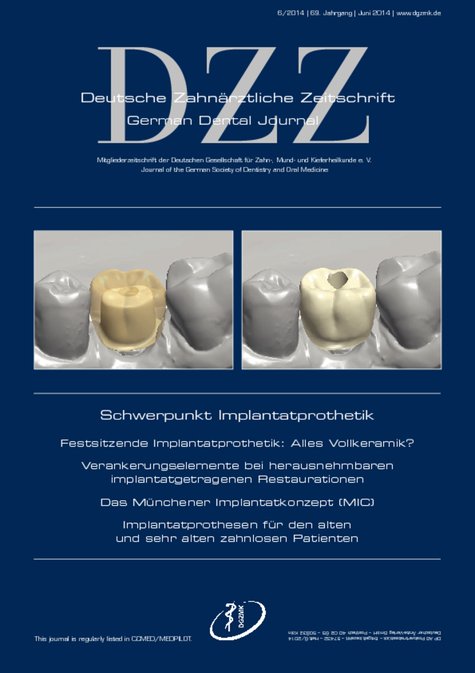 Deutsche Zahnärztliche Zeitschrift, 6/2014