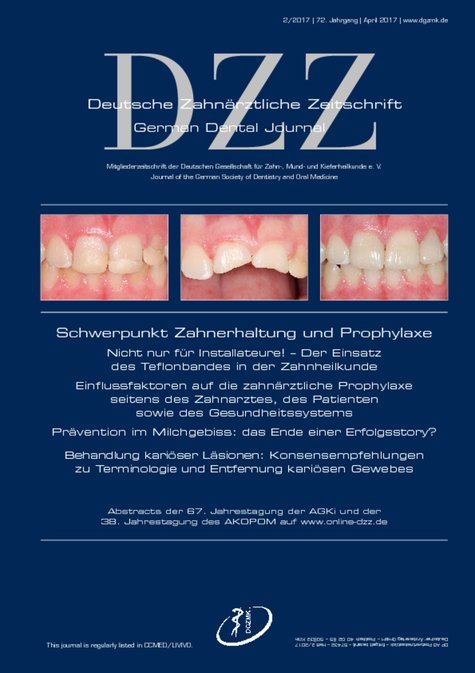 Deutsche Zahnärztliche Zeitschrift, 2/2017