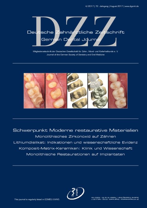Deutsche Zahnärztliche Zeitschrift, 4/2017