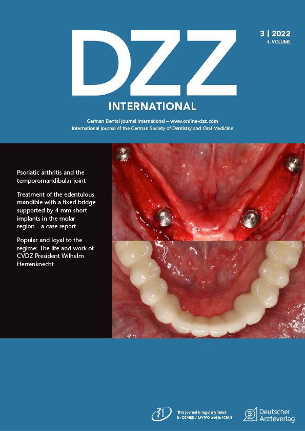DZZ International, 3/2022
