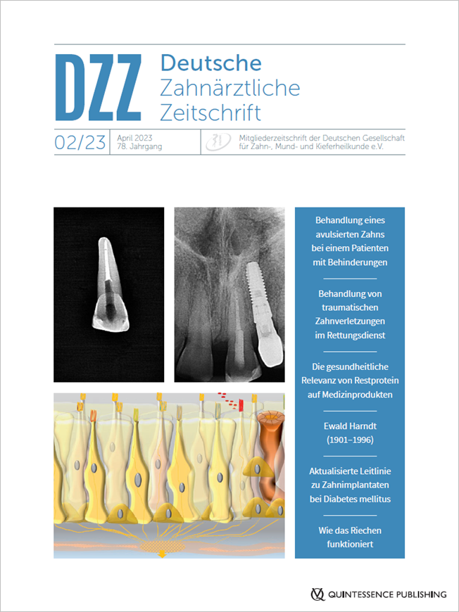 Deutsche Zahnärztliche Zeitschrift, 2/2023