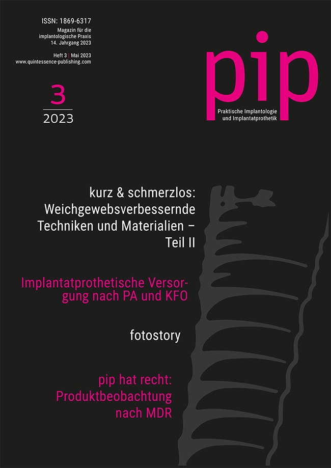 pip - Praktische Implantologie und Implantatprothetik, 3/2023