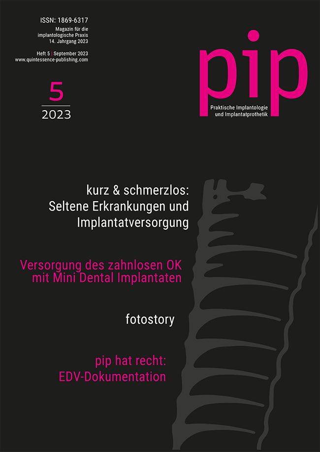 pip - Praktische Implantologie und Implantatprothetik, 5/2023