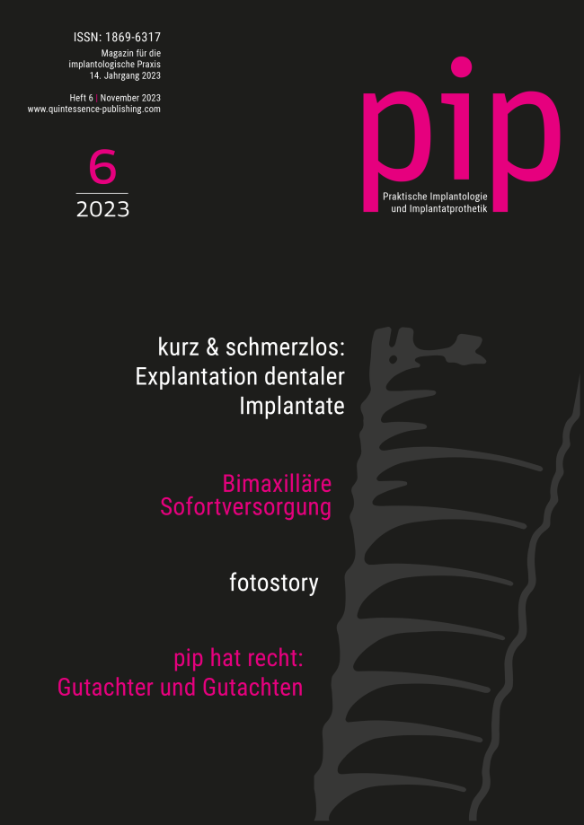 pip - Praktische Implantologie und Implantatprothetik, 6/2023
