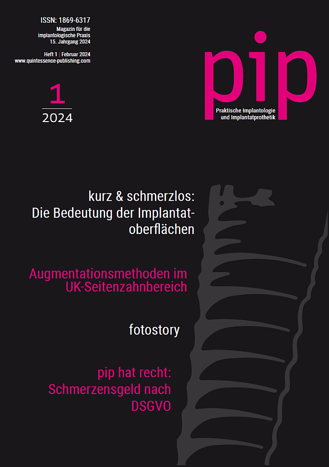 pip - Praktische Implantologie und Implantatprothetik, 1/2024