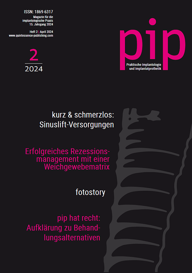 pip - Praktische Implantologie und Implantatprothetik, 2/2024