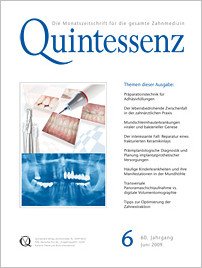 Quintessenz Zahnmedizin, 6/2009